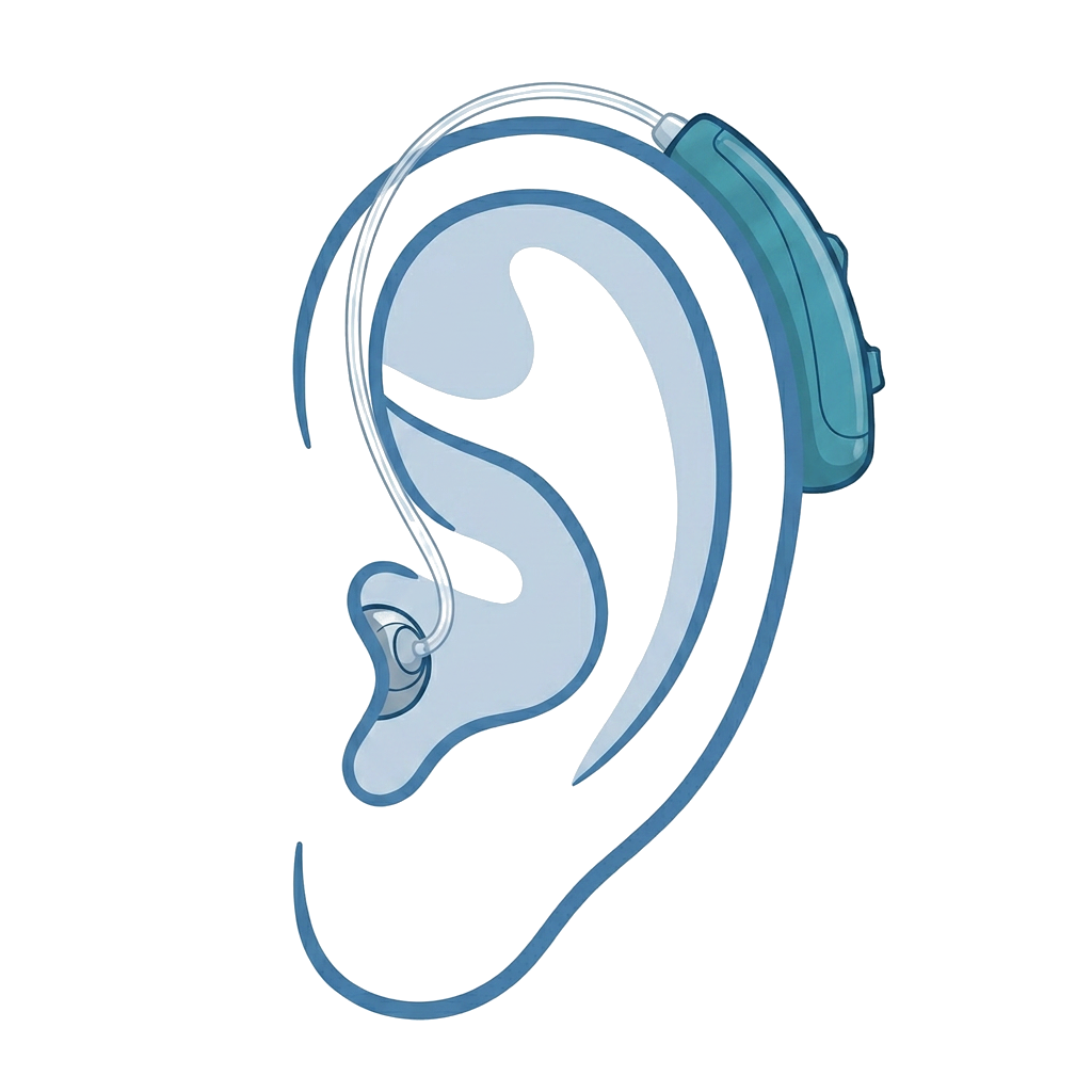 Receiver in Canal (RIC) hearing aid illustration showing placement on the ear